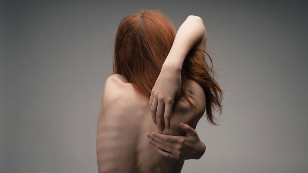 Los clásicos y los nuevos trastornos de la conducta alimentaria