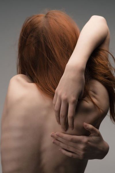 Los clásicos y los nuevos trastornos de la conducta alimentaria